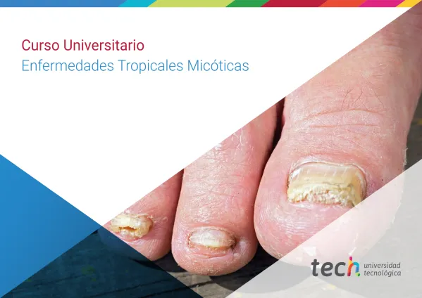 Curso Universitario en Enfermedades Tropicales Micóticas