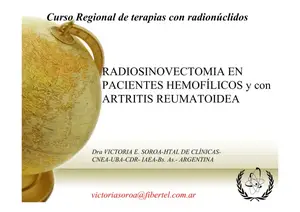 Radiosinovectomía en Artritis Reumatoide